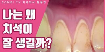[대한건강의료신문]-치석의-원인과-유난히-치석이-잘-생기는-이유