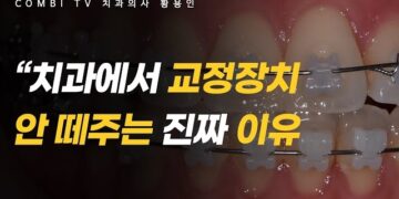 [대한건강의료신문]-치아교정-끝났는데-장치는-언제-떼나요?