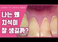 [대한건강의료신문]-치석의-원인과-유난히-치석이-잘-생기는-이유