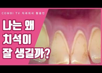 [대한건강의료신문]-치석의-원인과-유난히-치석이-잘-생기는-이유