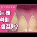 [대한건강의료신문]-치석의-원인과-유난히-치석이-잘-생기는-이유
