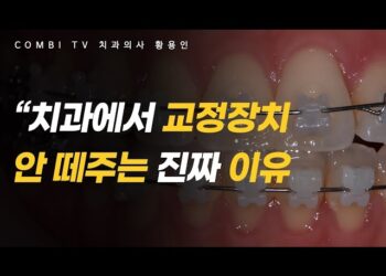 [대한건강의료신문]-치아교정-끝났는데-장치는-언제-떼나요?