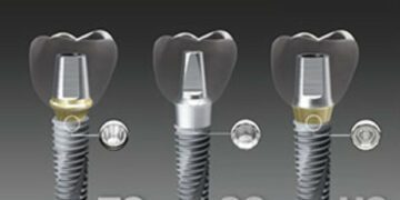 [대한건강의료신문]-대한민국-대표-임플란트-‘오스템임플란트’