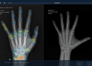 [대한건강의료신문]-국내1호-ai-의료기기-‘뷰노메드본에이지’