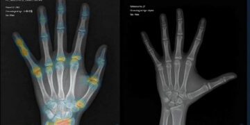 [대한건강의료신문]-국내1호-ai-의료기기-‘뷰노메드본에이지’