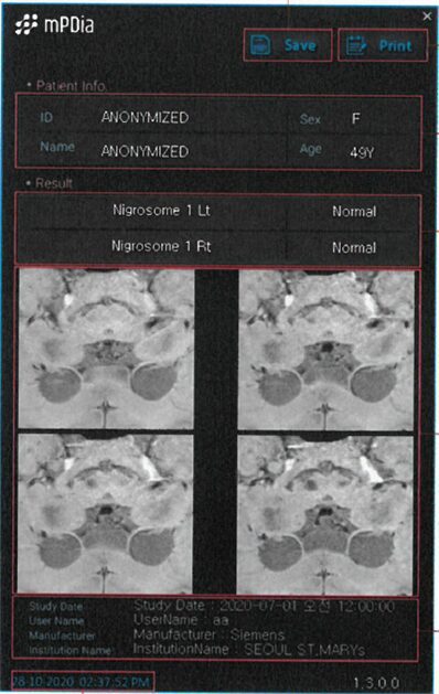 (주)휴런의 인공지능(AI)을 적용해 MRI 영상에서 파킨슨병 여부를 진단 보조하는 혁신의료기기 (사진 제공=식품의약품안전처)